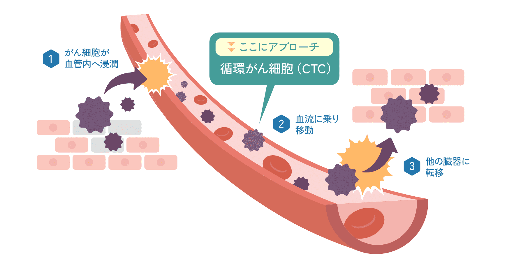 がん細胞に対するアプローチ方法